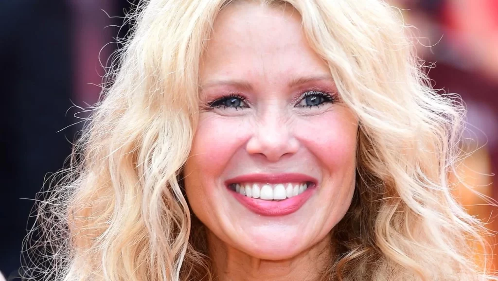 Celebrities Who Have Had A Thread Lift | Melinda Messenger